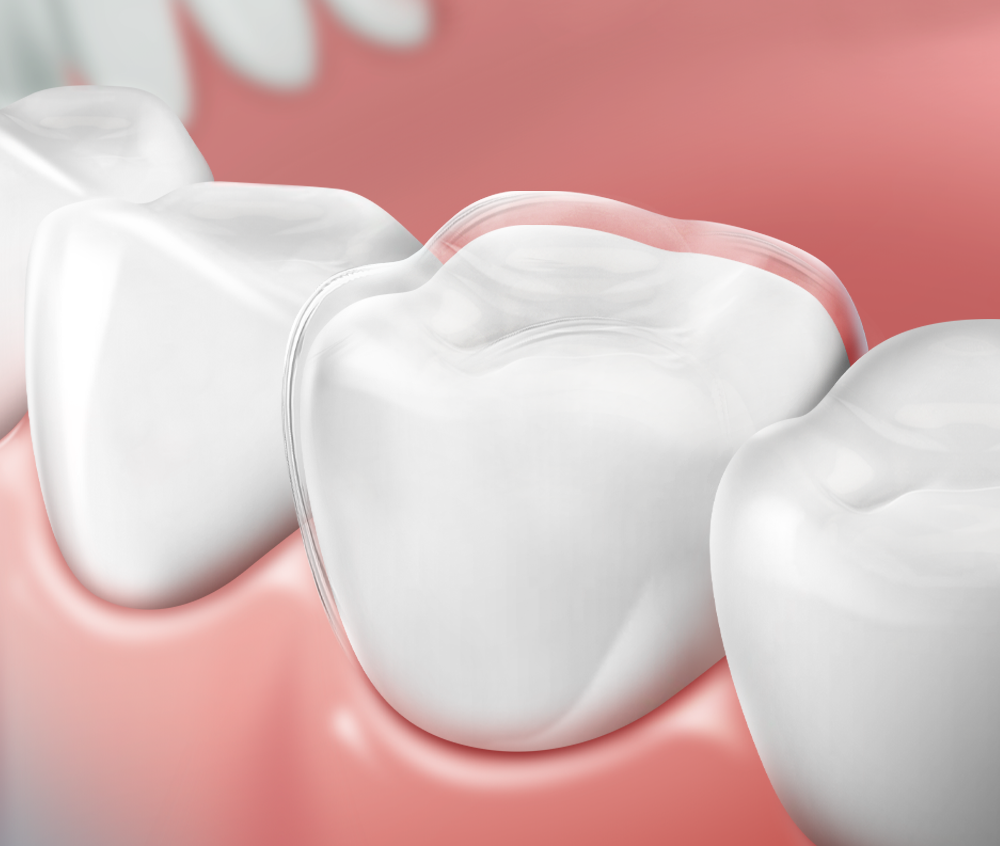 서울시온치과 협진 진료